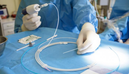 NTX varicose vein surgeon